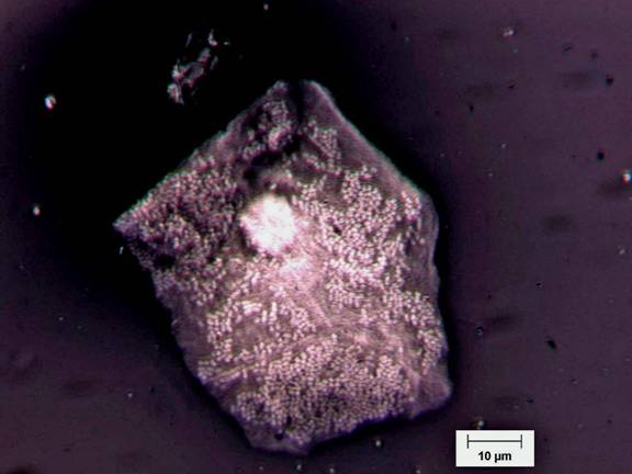 A squamous epithelial cell with adherent diplococcus-type bacterial cells.