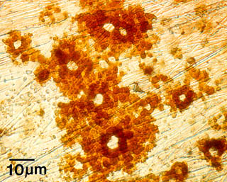 Biofilm Lifecycle