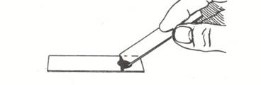 Second step in procedure for making a nigrosine smear.