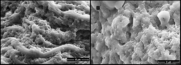 Scanning Electron micrographs of tissue specimens from chronic wounds 