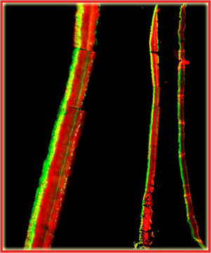 DNA Synthetic Activity in Biofilm