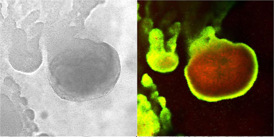 GFP Expression in P. aeruginosa Biofilm