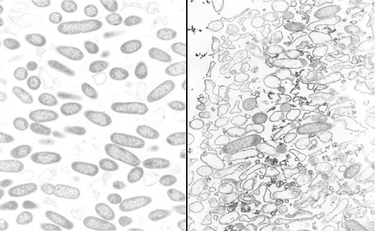 Tobramycin versus P. Aeruginosa Biofiofilm